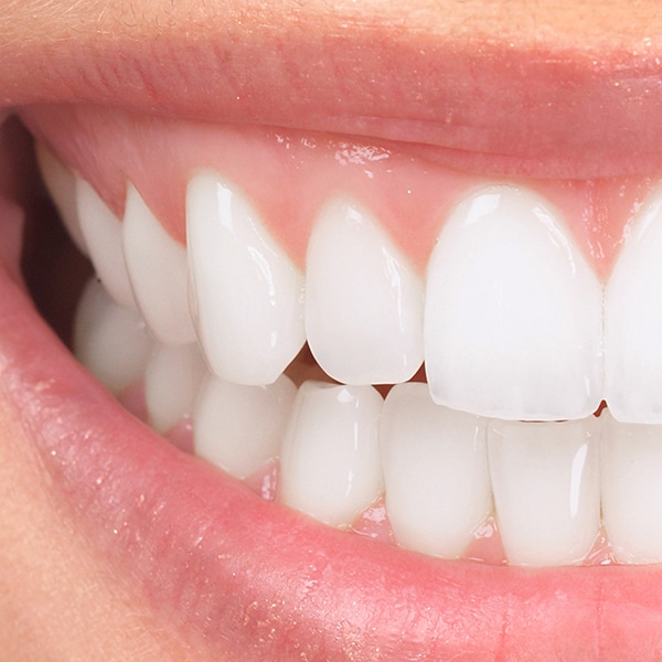 La oclusión o mordida ideal se produce cuando los dientes superiores e inferiores encajan perfectamente.