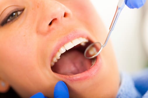 Síntomas que te indican que necesitas una visita al dentista inmediatamente
