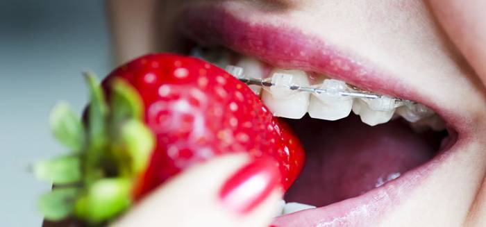 Alonso Dental - Ortodoncia y Alimentos