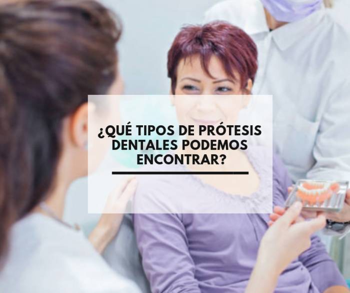 ¿Qué tipos de prótesis dentales podemos encontrar?