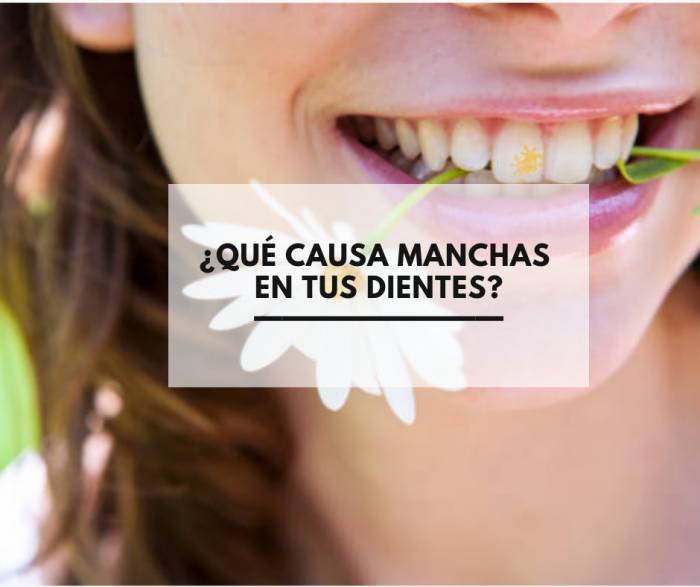 ¿Qué causa manchas en tus dientes?