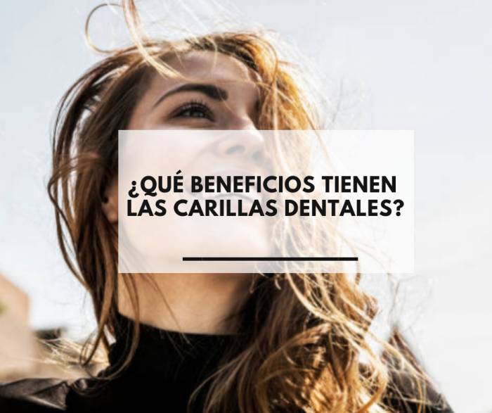 ¿Qué beneficios tienen las carillas dentales?