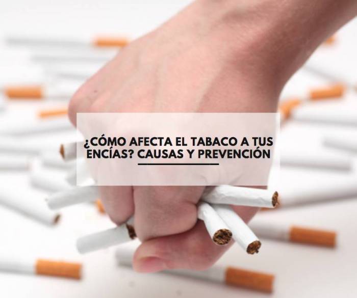 ¿Cómo afecta el tabaco a tus encías? Causas y prevención